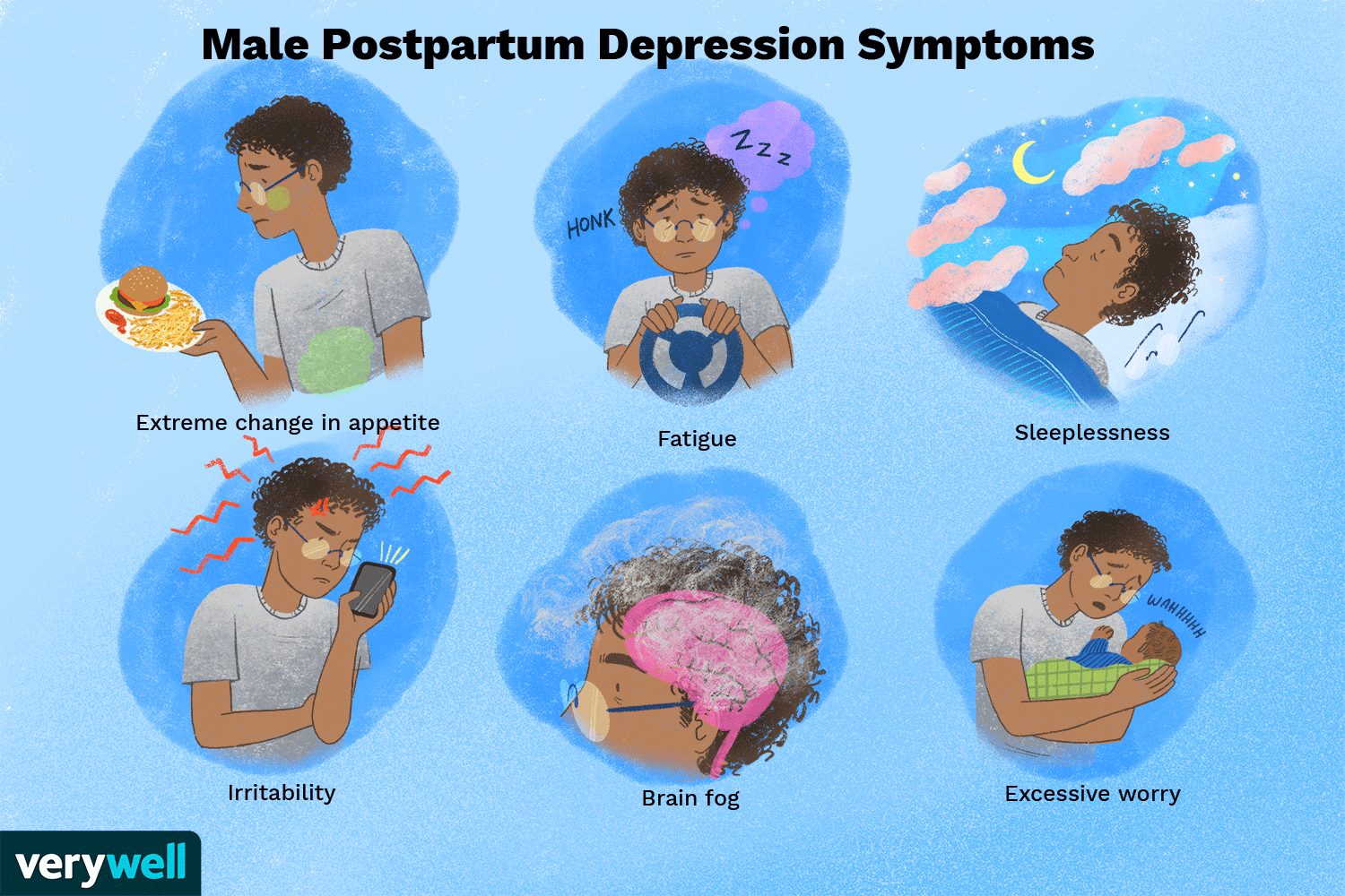 ¿Qué es la depresión posparto masculina?
