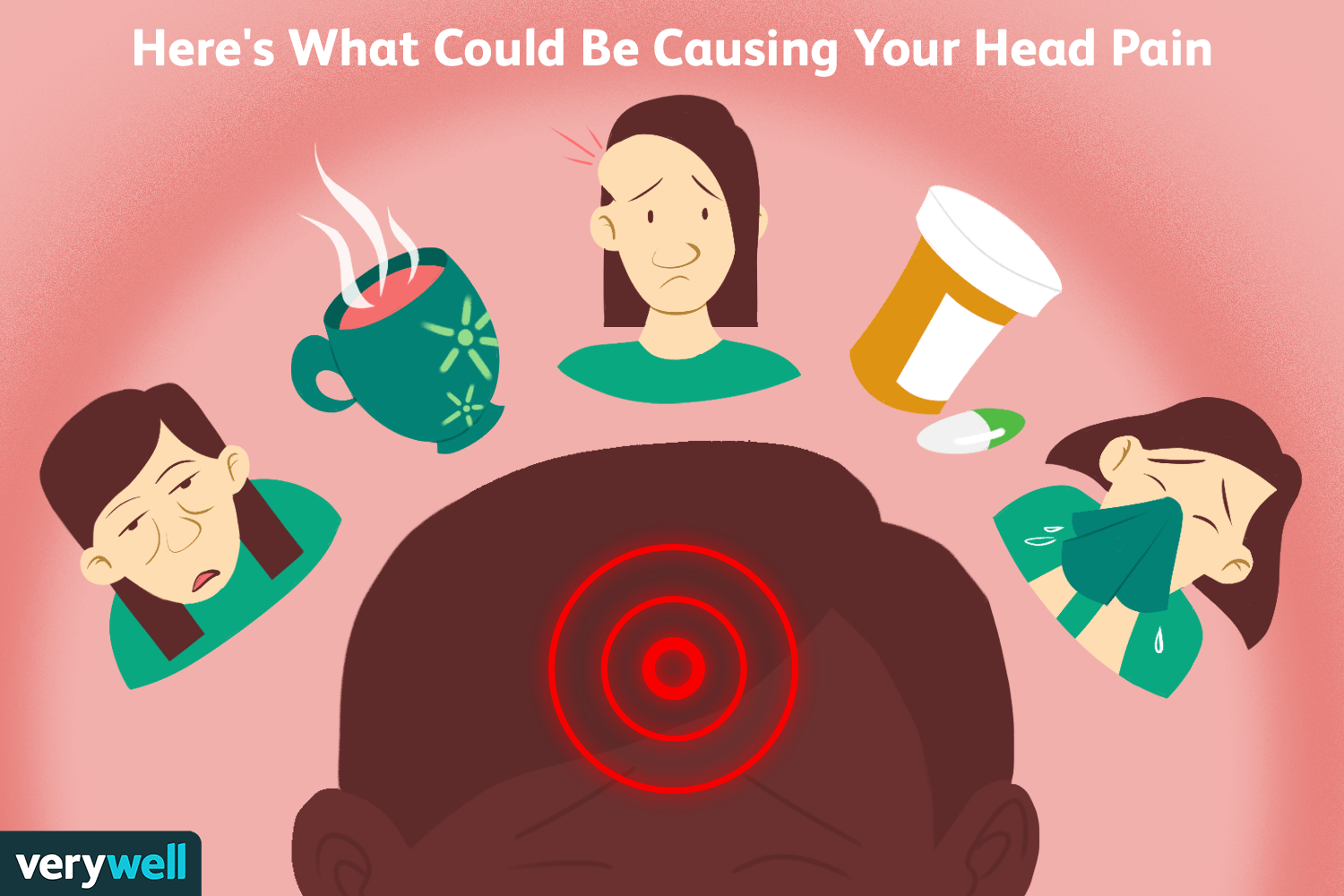 Esto es lo que podría estar causando su dolor de cabeza