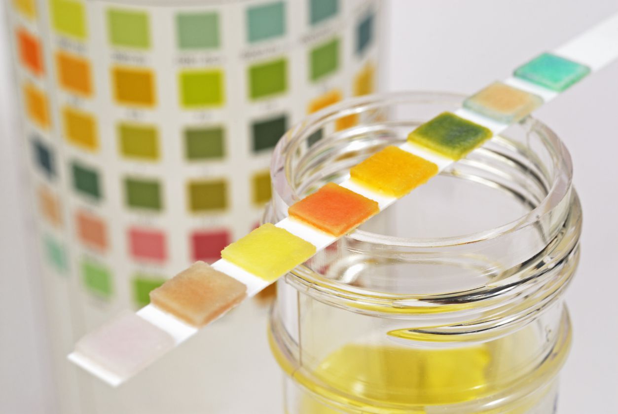 La verdad sobre las pruebas de detección de drogas en el hogar para adolescentes